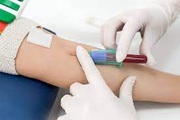 Fever Panel Test in Mumbai - Redcliffe Labs