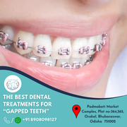 Top dental clinic near me|Best orthodontics dental centre Bhubaneswar