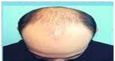 Integrative Treatment for Hair loss  Diagnostic Testing