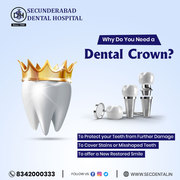 Best Dental hospital in Hyderabad - Dental clinics near me