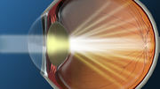 Best Eye Clinic In Pune | Best Eye Specialist In Pune