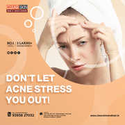 Laser treatment clinic in india
