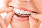 invisible teeth aligners