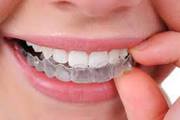 Invisalign India