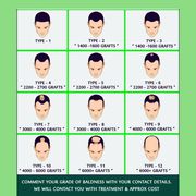 Hair Transplant in Patna