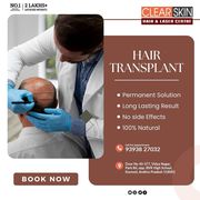 Regenera Activa hair  Treatment in Andhra Pradesh AP