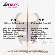 Best Hair Loss Treatment in Ahmedabad,  Avenues Cosmetic.