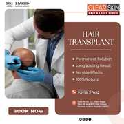 best Tattoo removal treatment in Andhra Pradesh AP
