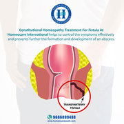 Homeopathy Treatment for Anal Fistula - Homeocare International
