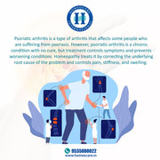 Arthritis Treatment in Homeopathy - Homeocare International