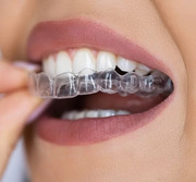 Best Braces Specialist in Satellite,  Ahmedabad
