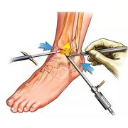 Arthroscopy Surgeon in Ahmedabad