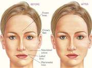 Best plastic surgeon in india