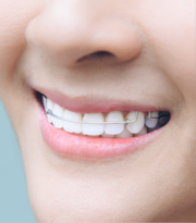 ONE DENTALL DENTAL SERVICE (BELAGAVI)