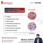 Expert Care for Leukemia: Dr. S.K. Gupta,  Renowned Leukemia Specialist