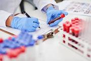 Blood Investigations at Healthanza – Precision Care by Dr. Naveen Sola