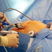 Laparoscopy Training in India