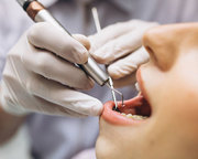 Dental Implants in Ludhiana