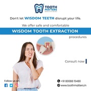 Zirconia Crown Treatment and Safe Tooth Extraction at Tooth Matters
