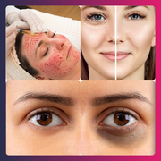 Hair Patch in Sector 18 Noida