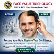 Before & After Hair Transplant Results in Chennai | Restore Your Confi